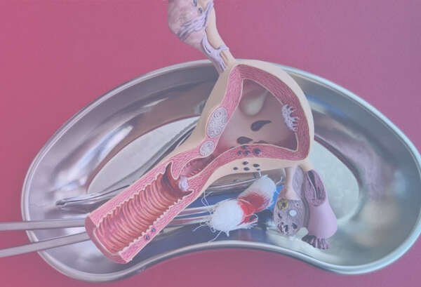 hysterectomy surgery