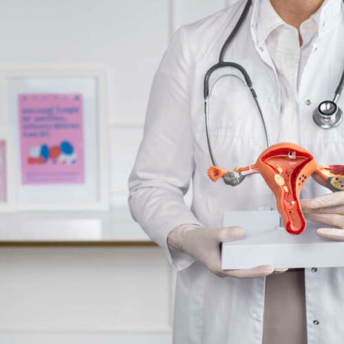front-view-doctor-holding-anatomic-model hysteroscopy surgery