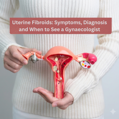 Uterine Fibroids: Symptoms, Diagnosis and When to See a Gynaecologist