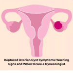 Ruptured Ovarian Cyst Symptoms: Warning Signs and When to See a Gynecologist